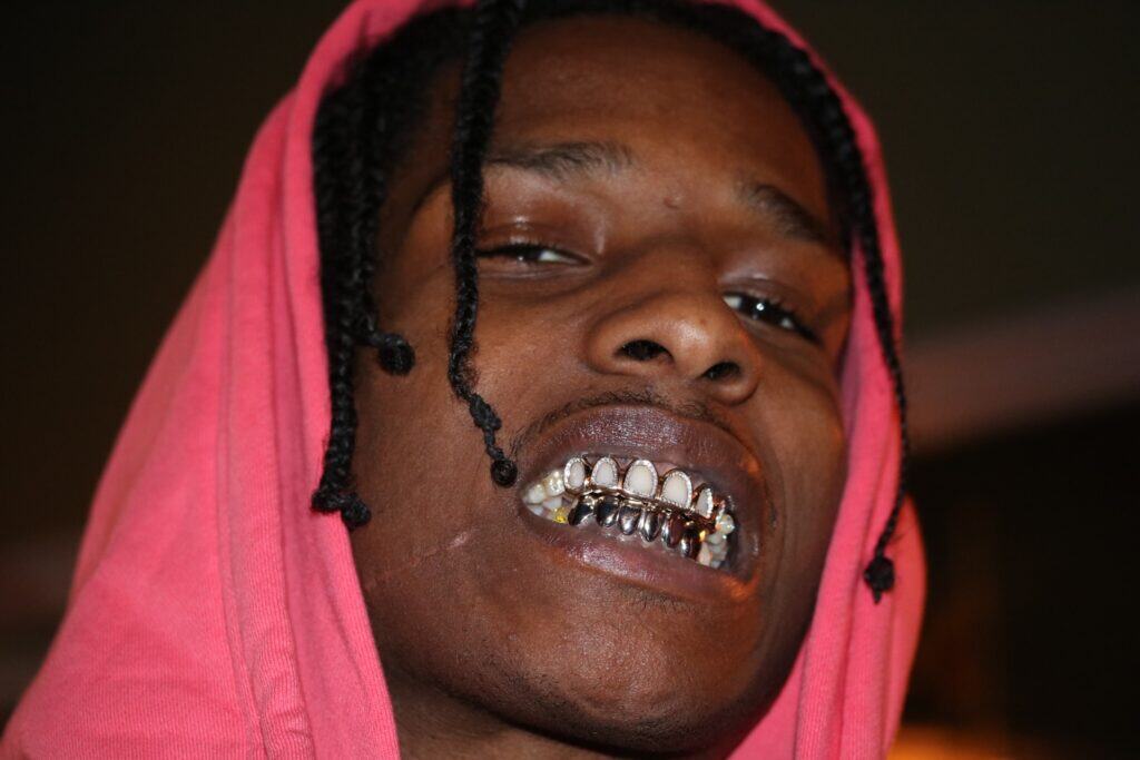 Gabby Elan, Custom Grillz