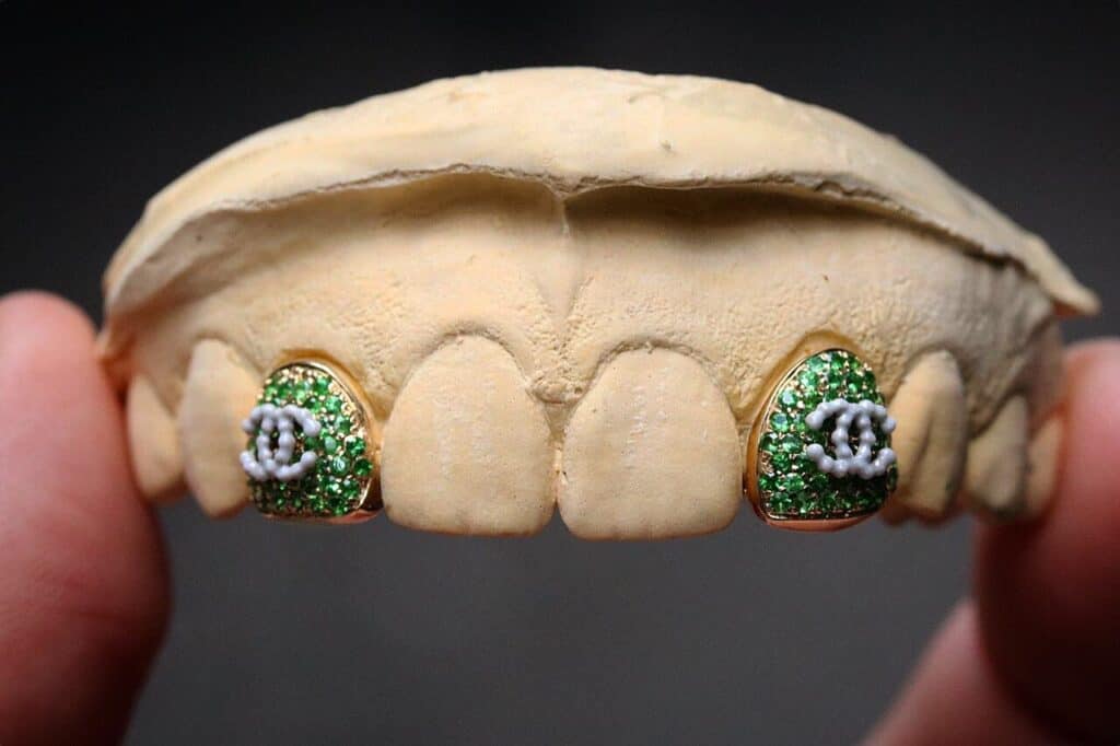 Gabby Elan, Custom Grillz