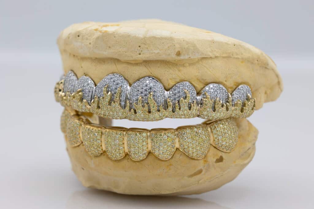 Gabby Elan, Custom Grillz