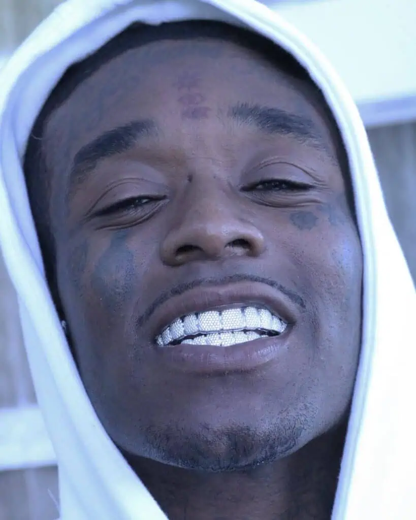 Gabby Elan, Custom Grillz