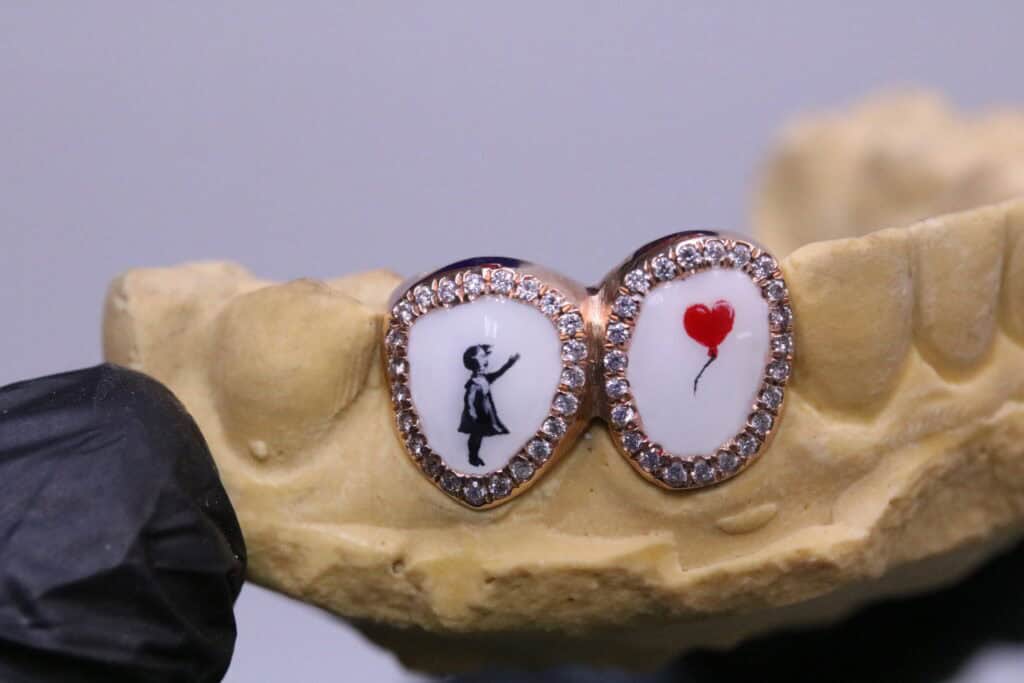 Gabby Elan, Custom Grillz